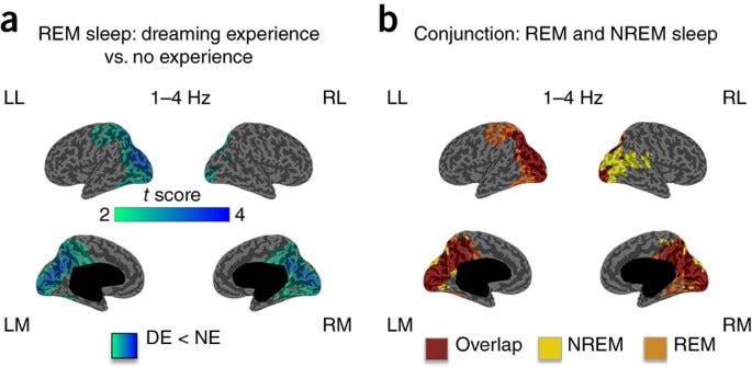 Brain activity during sleep study