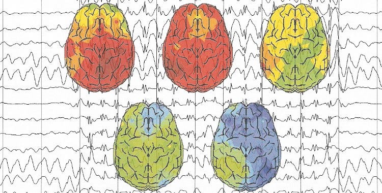 EEG brain wave patterns illustrating mental activity