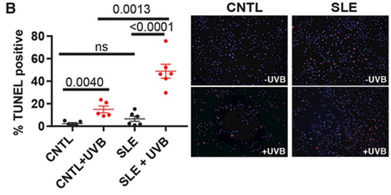 Apoptotic cells in UV-irradiated skin samples