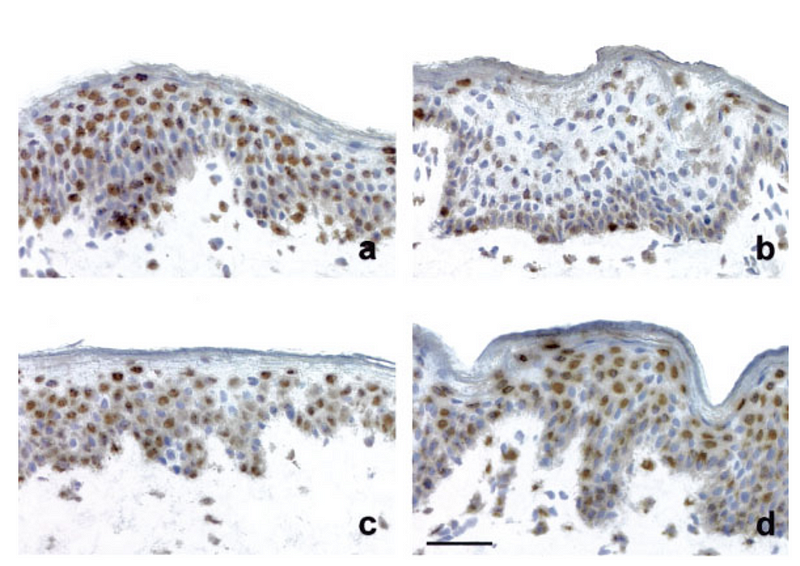 Apoptotic cells in skin biopsies post-irradiation